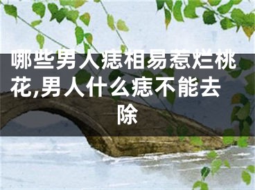 哪些男人痣相易惹烂桃花,男人什么痣不能去除