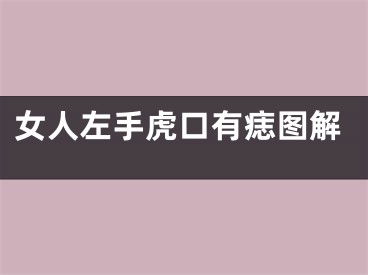 女人左手虎口有痣图解