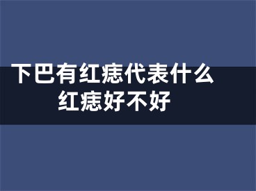 下巴有红痣代表什么 红痣好不好 